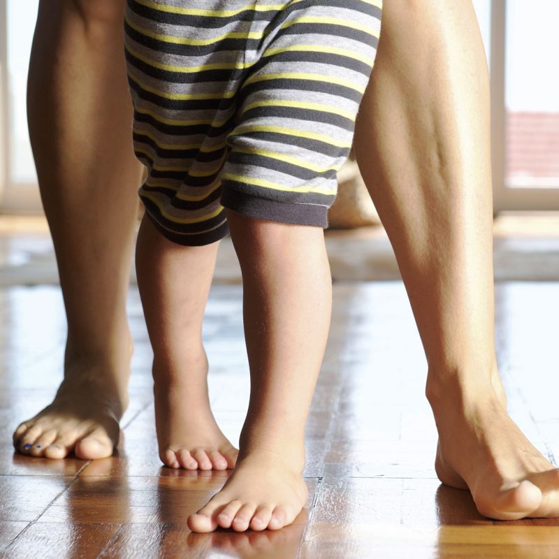 InToeing (Pigeon Toes) Orthopaedia