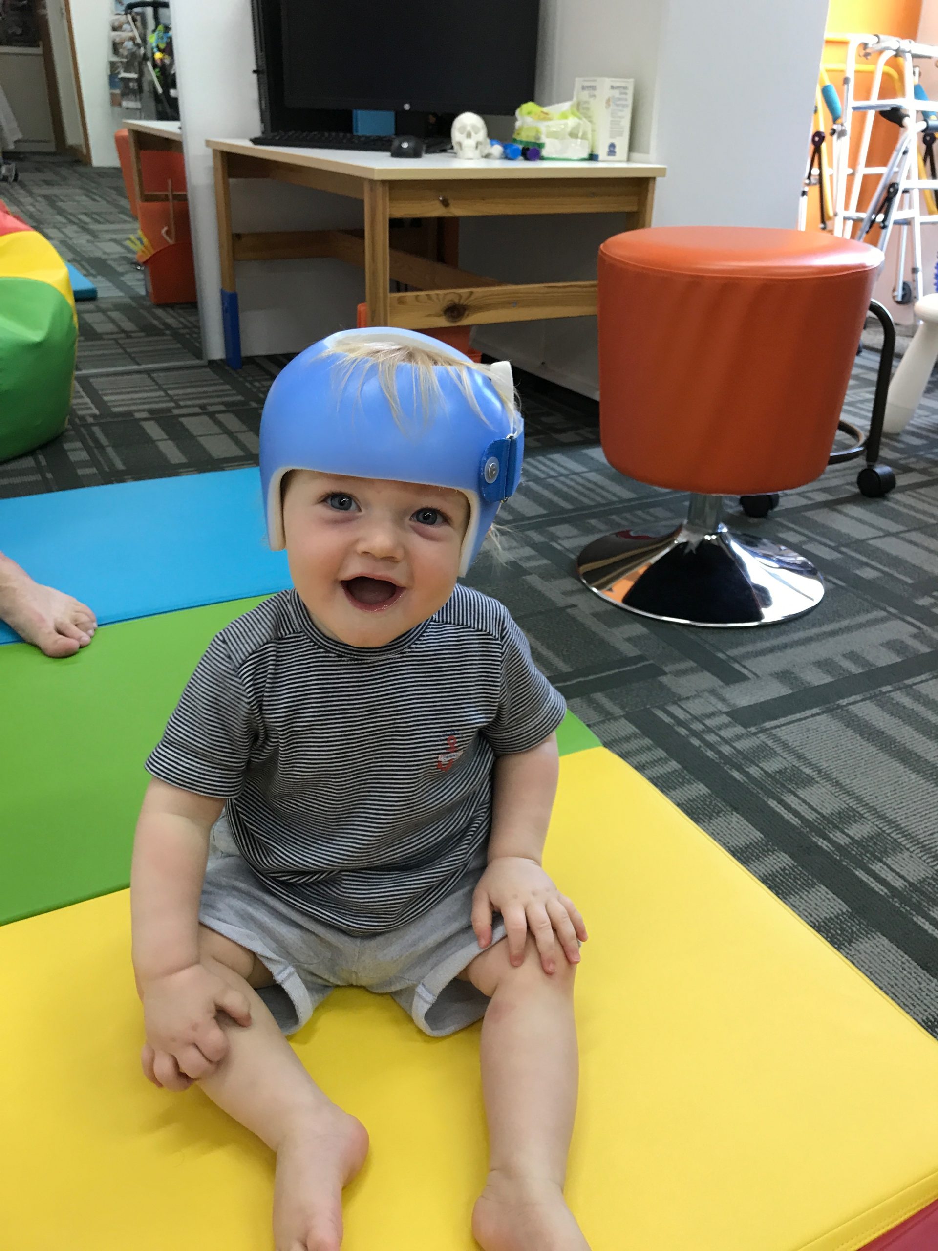 Happy Helmet Babies Orthopaedia