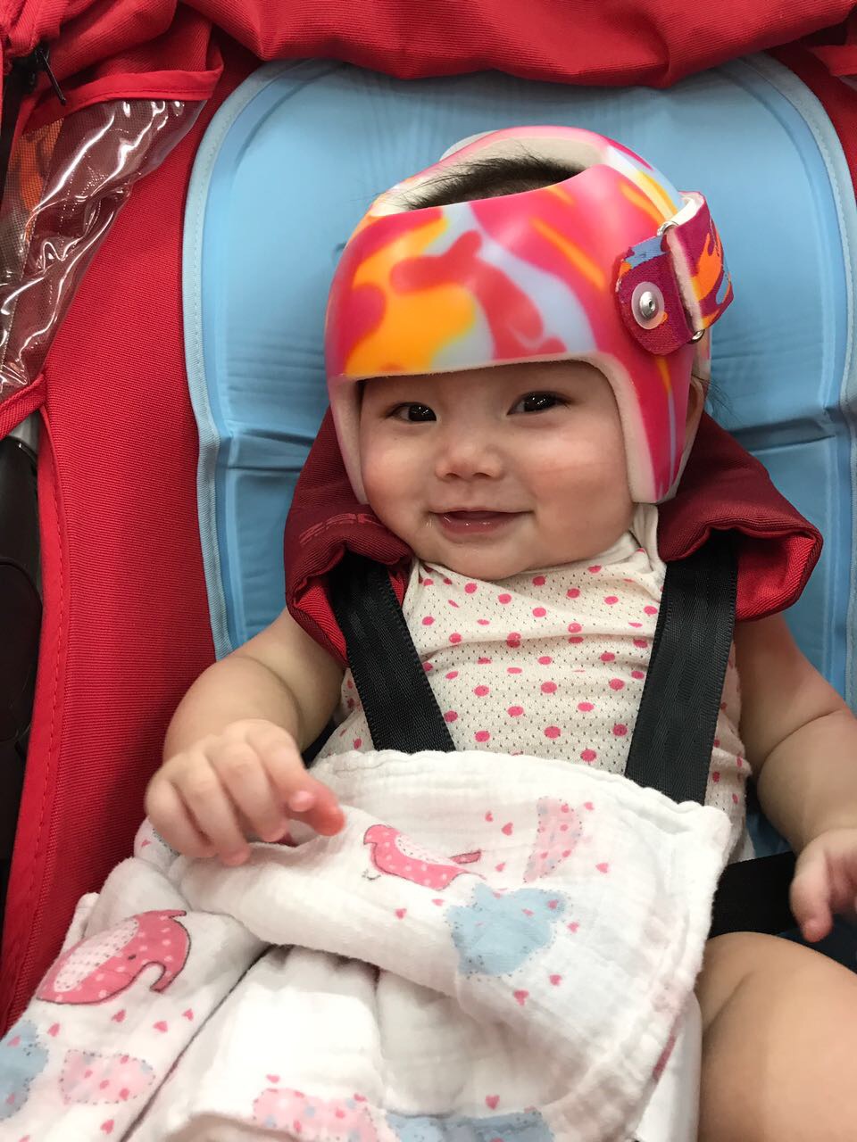 Happy Helmet Babies Orthopaedia