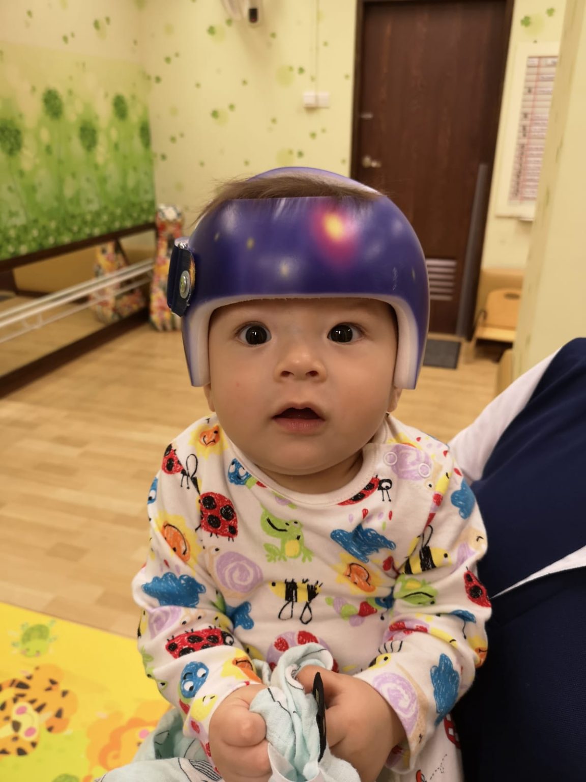 Happy Helmet Babies Orthopaedia